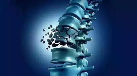 春夏補(bǔ)鈣好時期 骨密度儀來助陣